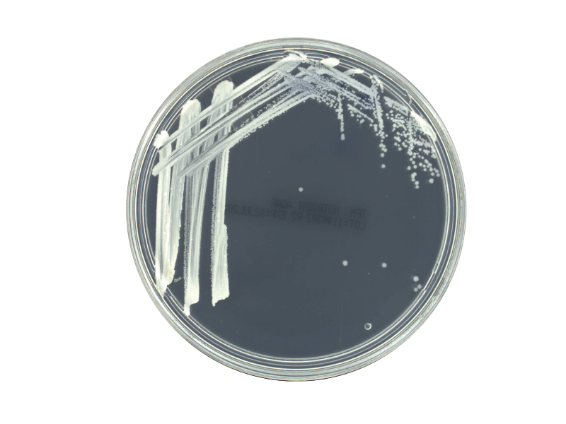 Nutrient Agar Nutrient Agar