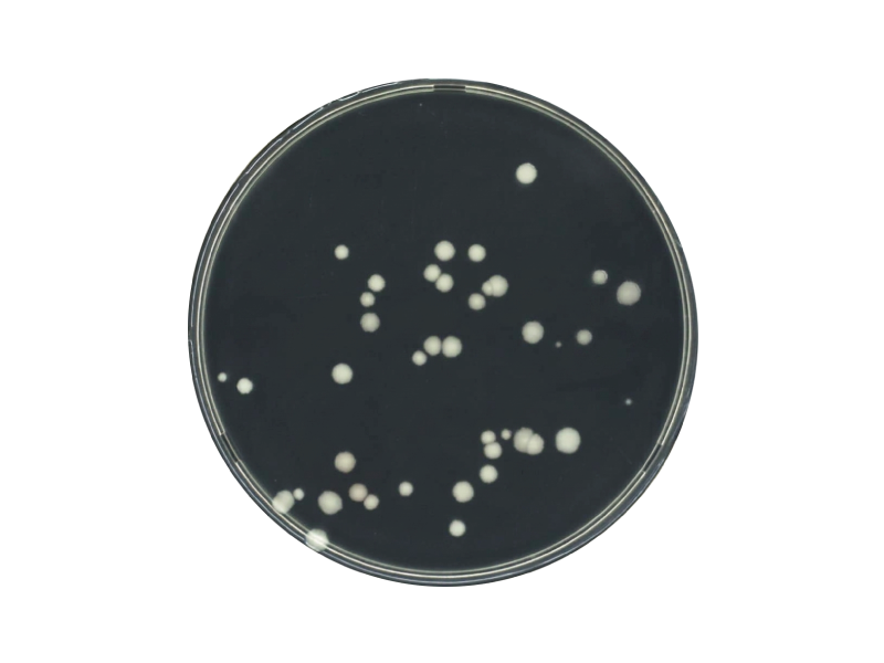 Plate count agar (PCA) Plate count agar (PCA)