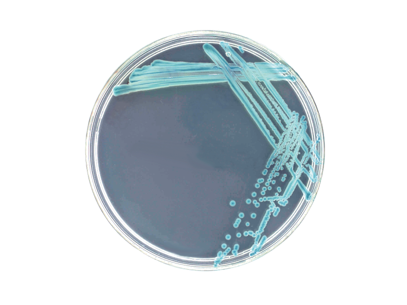 tryptone-bile X-glucuronide agar (TBX) tryptone-bile X-glucuronide agar (TBX)