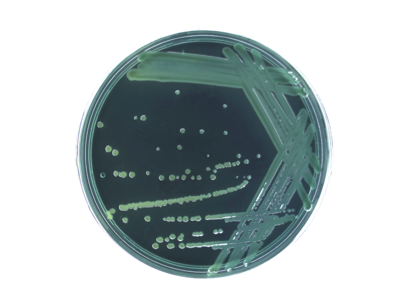 Thiosulfate Citrate Bile Salts Surcose (TCBS) Agar Thiosulfate Citrate Bile Salts Surcose (TCBS) Agar