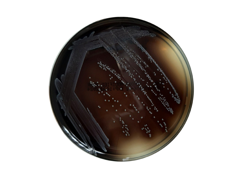 Oxford Modified Agar (MOX) Oxford Modified Agar (MOX)