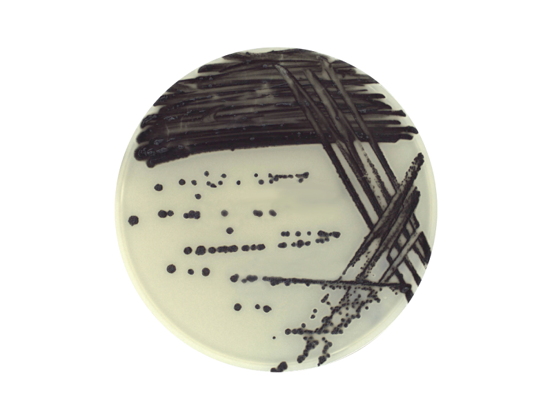 Tryptose-sulfite-cycloserine (TSC) agar Tryptose-sulfite-cycloserine (TSC) agar