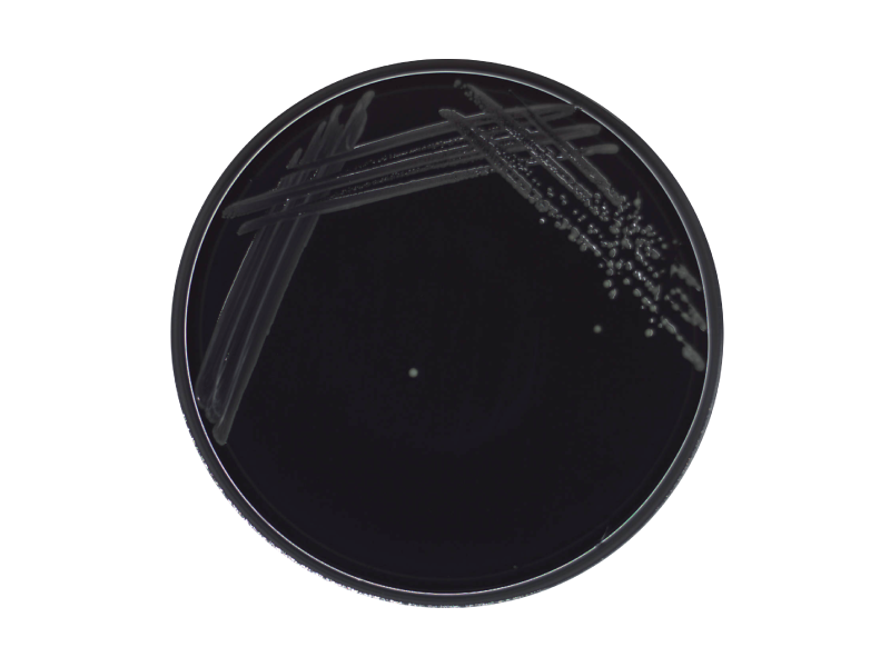 Modified Campylobacter blood-free agar (mCCDA) Modified Campylobacter blood-free agar (mCCDA)