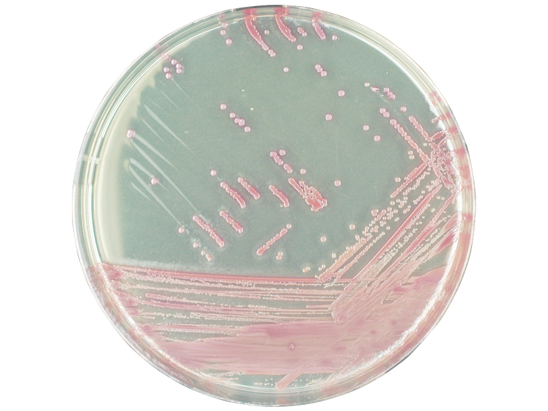 Staphylococcus aureus среда. Агар хромогенный MRSA. Золотистый стафилококк MRSA. Хромогенный агар для стафилококков. Хромогенные питательные среды.
